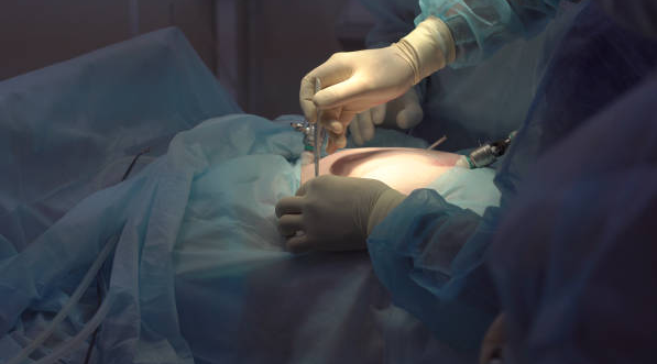 Laparoscopic Gynecologist: Redefining Women's H... main image