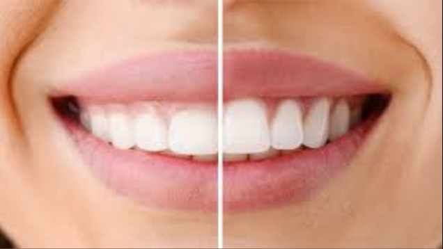 Revitalize Your Smile: Gum Surgery at Medisky M... main image