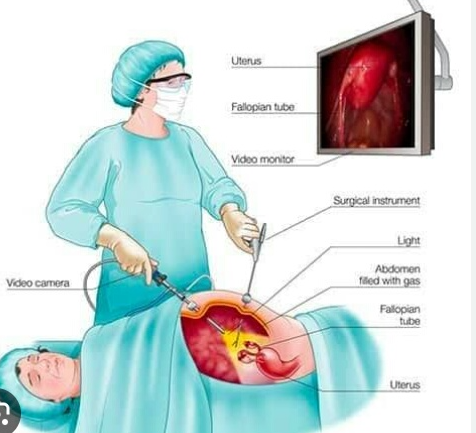 Dr. Rajiv Manek: Top Laparoscopic Surgery Speci... main image