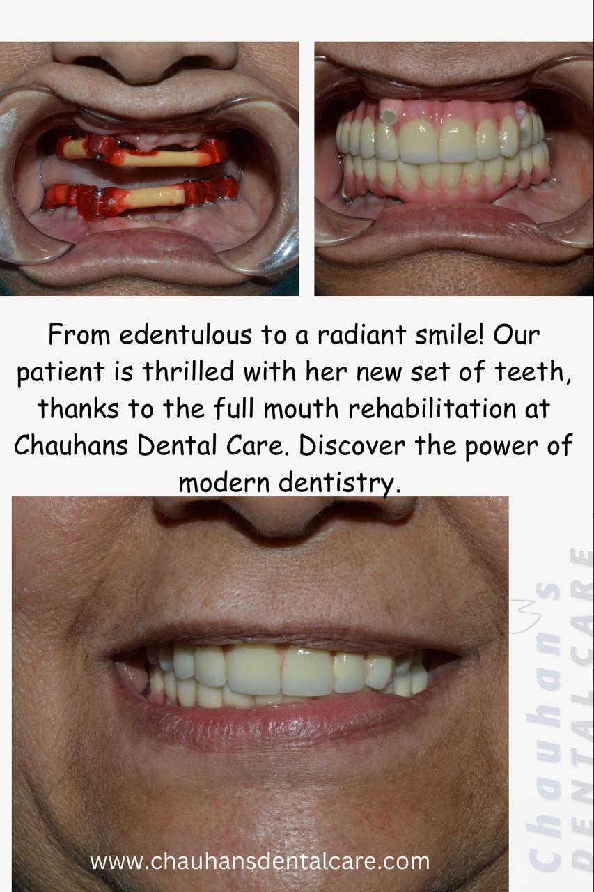 Our mission at Chauhans Dental Care is to provide ... main image
