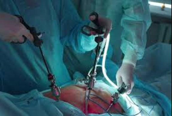Gall Bladder Surgeon Near Me The Best Gall Blad... main image