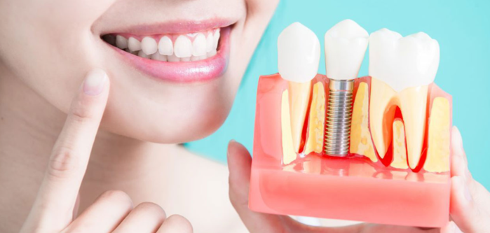 Advanced Dental Implant Surgery at Dr. Rai's Denta... main image