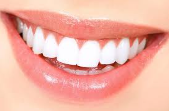 Perfecting Your Pearly Whites: Tooth Color Rest... main image