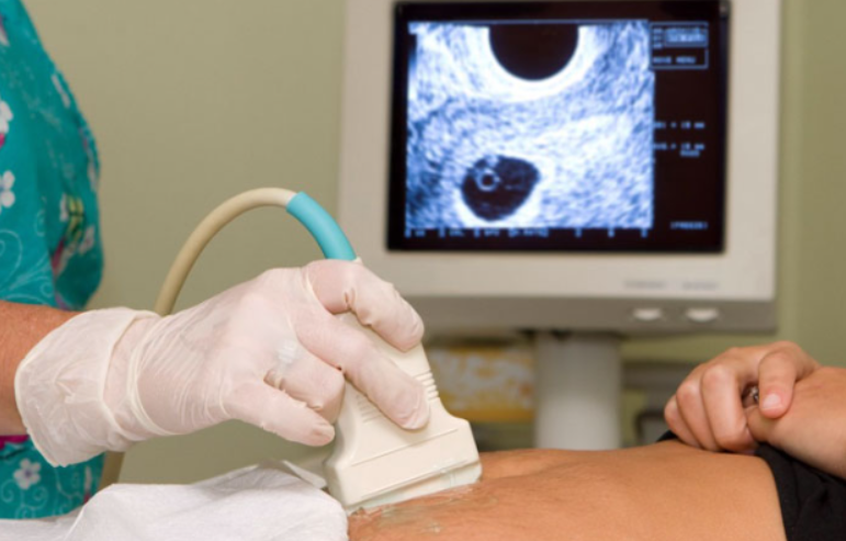 Ultrasound at Viveka