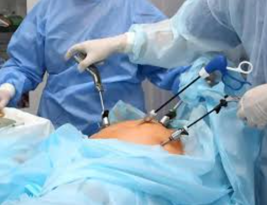 Laparoscopic Hysterectomy: A Safer and Smoother... main image
