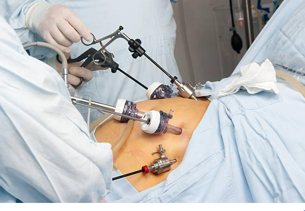 Leading Obesity Surgeon Near Me Best Obesity Su... main image