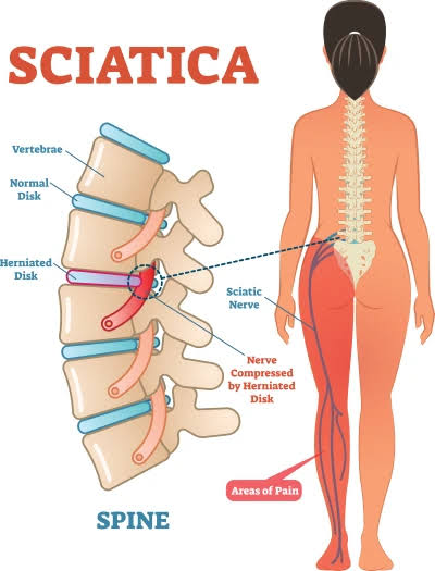 Physiotherapy clinic in Tambaram
Are you Looking f... main image