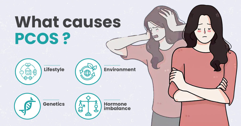 Polycystic Ovary Syndrome (PCOS), also known as... main image