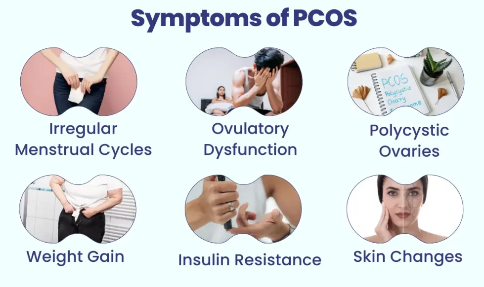 Symptoms of PCOD / PCOS :- 

Irregular Menstrua... main image