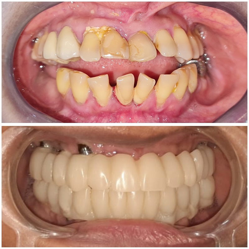 Teeth are the most underrated, yet most valuabl... main image