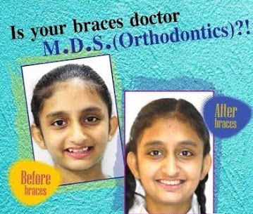 🦷 Clear Aligners Or Orthodontic Braces Benefits... main image