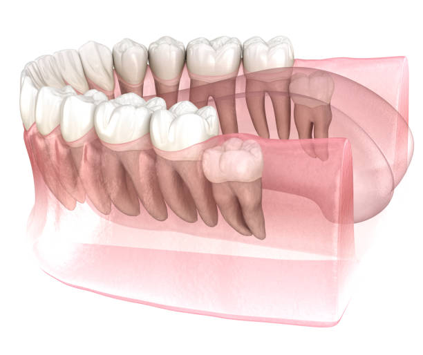 #Best implant center near me main image