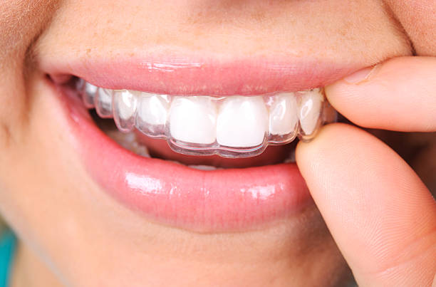 #Best braces doctor near me main image