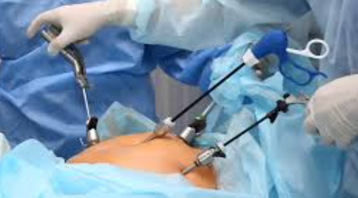 Laparoscopic Surgery: The Future of Minimally I... main image
