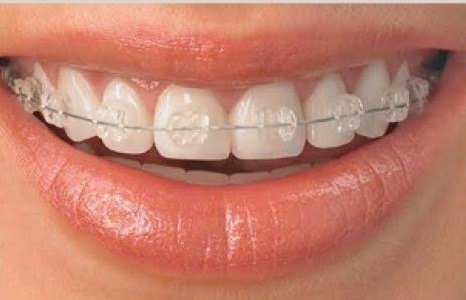 Paras Dental Care in Nirman nagar and Shyam nag... main image