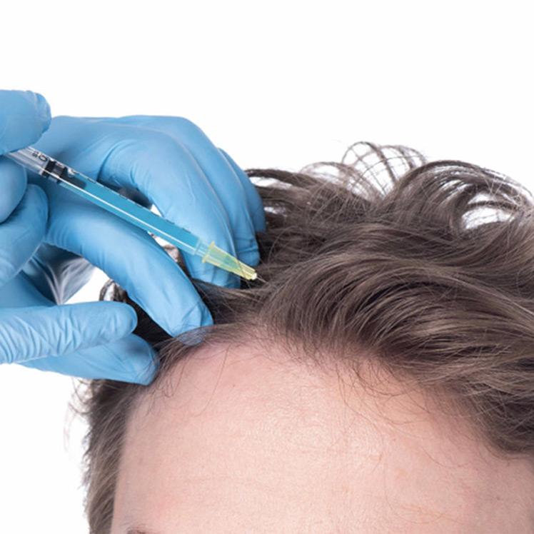 PGFRP Treatment is the most potent treatment yo... main image