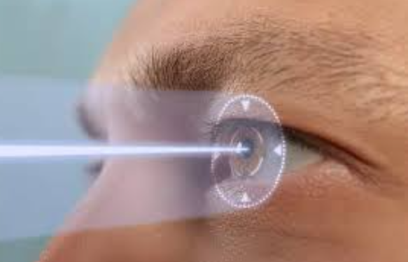 LASIK Laser Treatmen