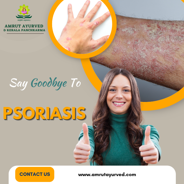 Psoriasis
a disorder where skin cells aggregate an... main image