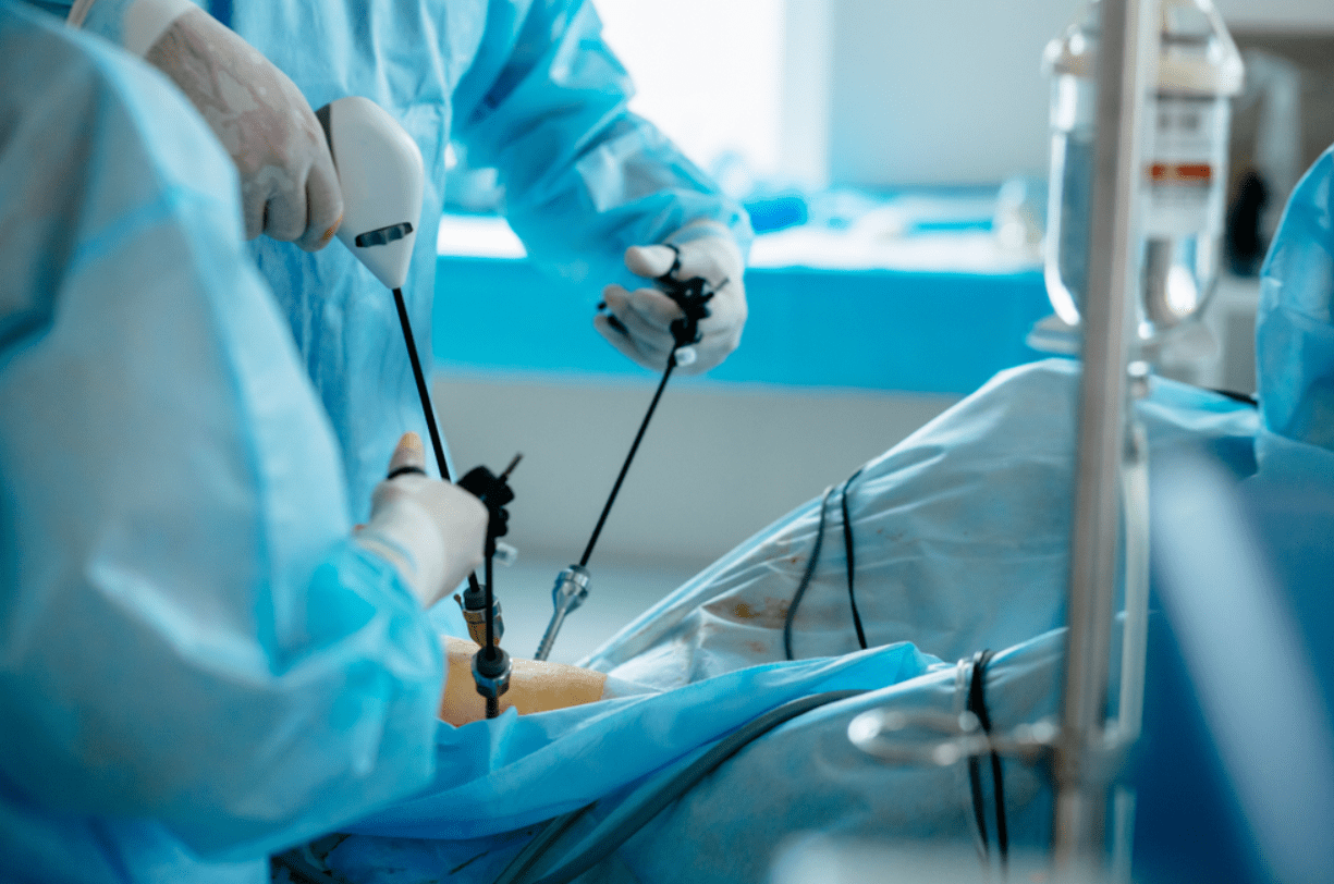 Top Laparoscopy Surgeon Services Top Laparoscop... main image
