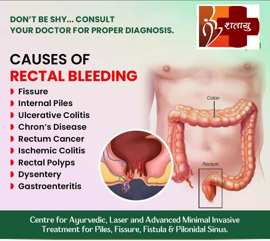 affordable piles treatment at #shatayupilesandg... main image