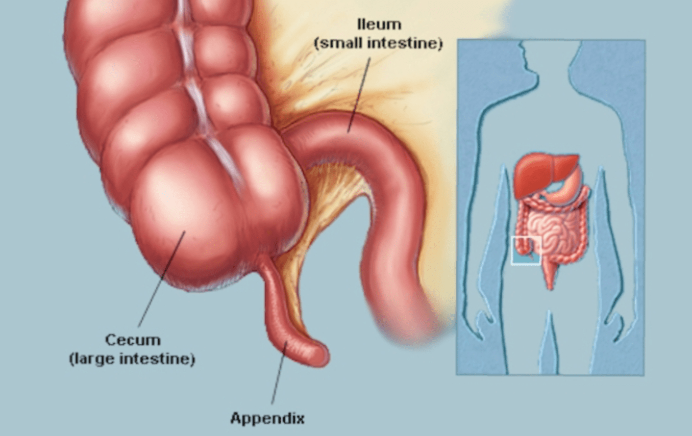 Expert Appendix Surgeon Services Expert Appendi... main image