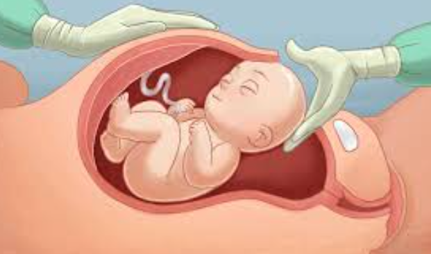 Normal Delivery and Caesarean Section at S A Ho... main image