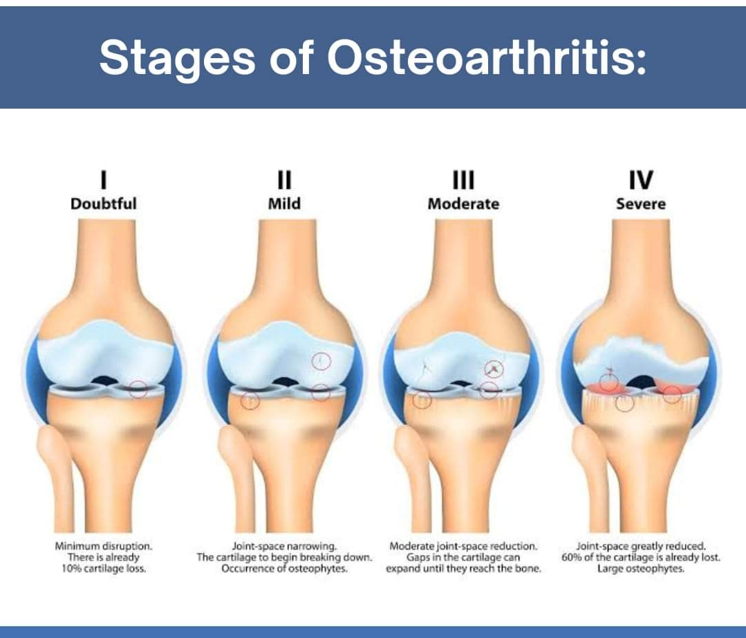Physiotherapy clinic in Tambaram
Are you Looking f... main image