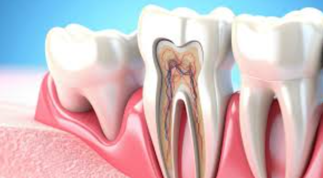 RCT Specialist in Jaipur Expert Root Canal Trea... main image