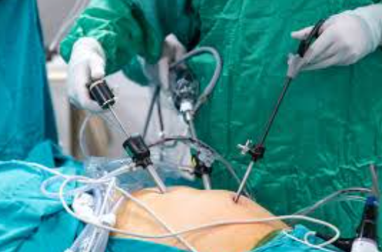 Advanced Laparoscopic Surgery by Dr. Bineet - B... main image