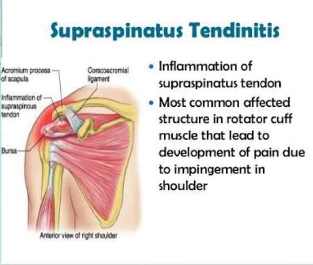 Physiotherapy clinic in Tambaram
Are you Looking f... main image