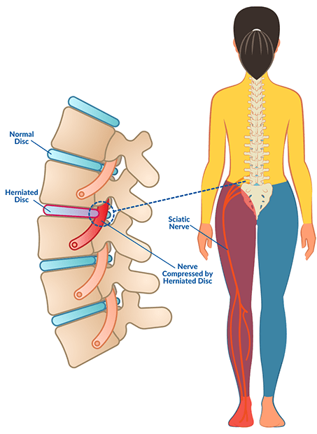 Physiotherapy clinic in Tambaram
Are you Looking f... main image