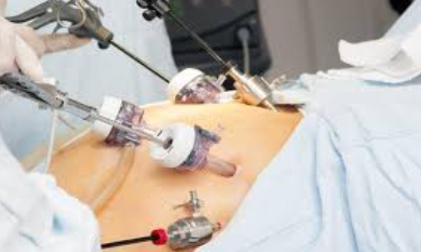 Laparoscopic Gynecologist Services at S A Hospi... main image