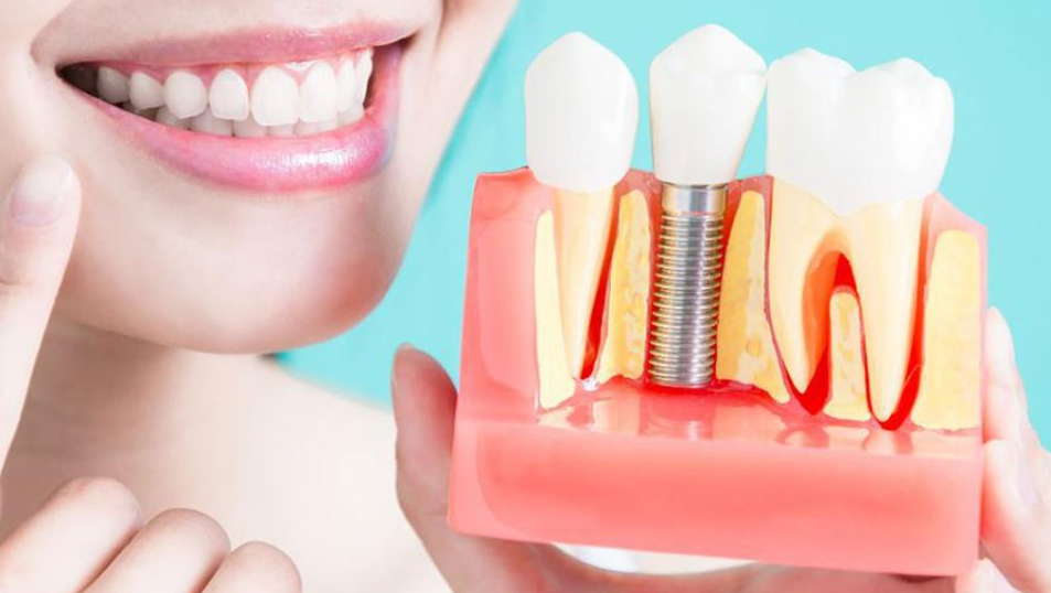 Dental Implant Surgery at Dr. Rai's Dental Avenue ... main image