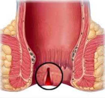 Fissure Surgeon: Comprehensive Care with Dr. Ra... main image