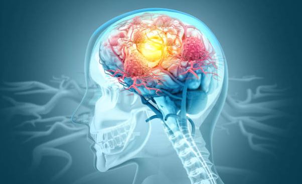 Neurosurgery Excellence at Ojasmultispecialityh... main image