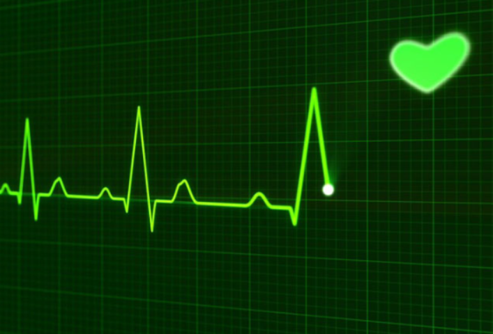 Reliable ECG Service