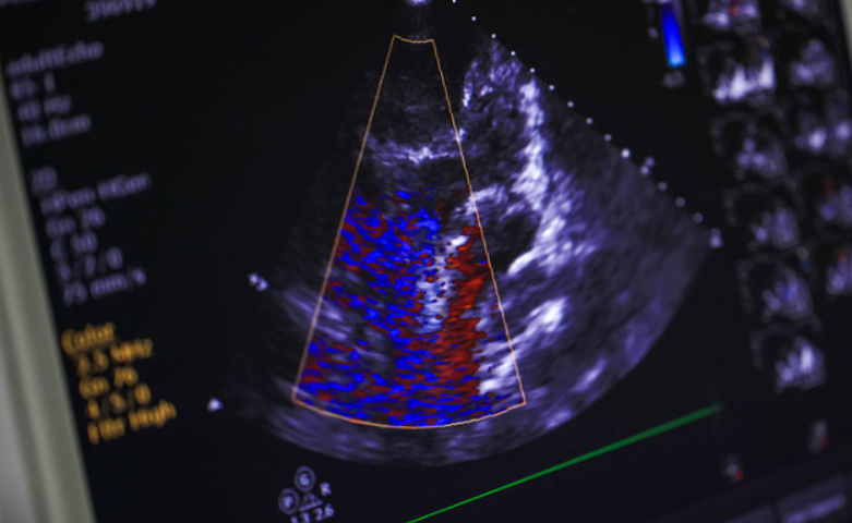 Superior Echocardiog