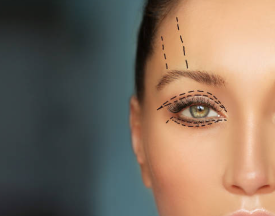 Oculoplasty Treatment: Enhancing Eye Appearance... main image