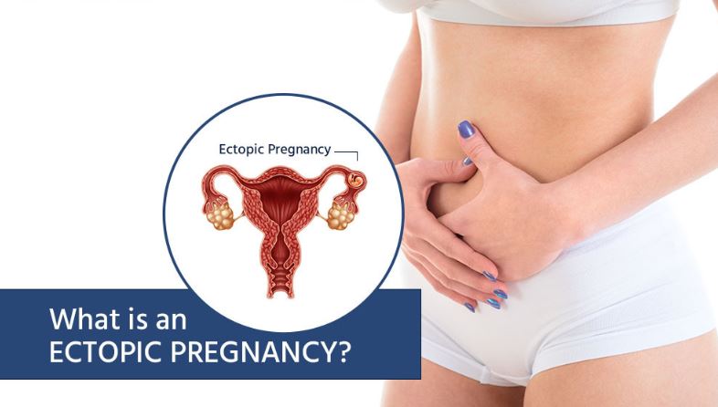 Best Ectopic Pregnancy Treatment Near Me in Nag... main image