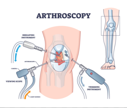 Arthroscopy at KC Hospital Best Arthroscopy Ser... main image
