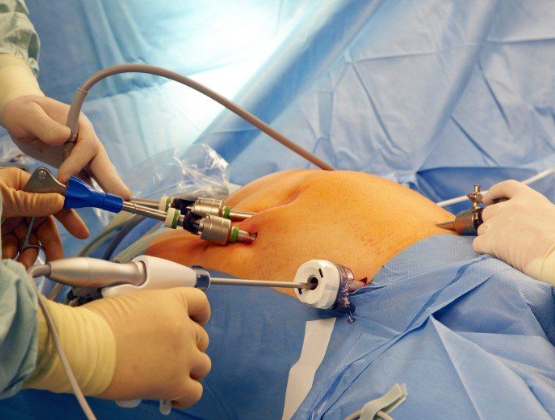 Key Hole Surgery in Avadi - Best Minimally Invasiv... main image