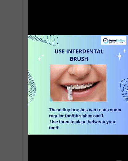 🦷✨ Rocking braces? Keep your teeth in top shape... main image