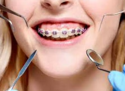 Braces Treatments at Dr. Rai's Dental Avenue in Th... main image