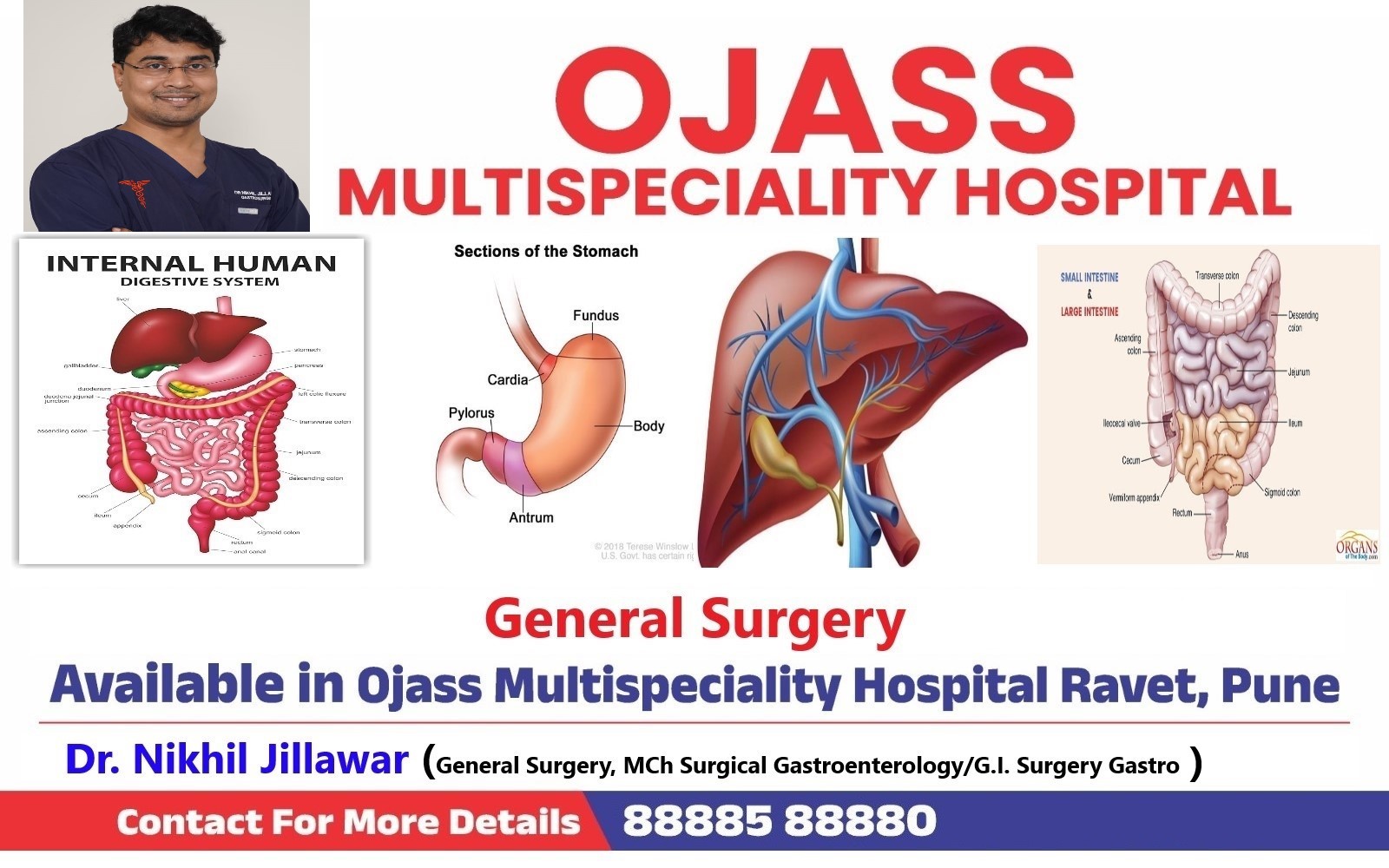 General Surgery is available at Ojass Multispecial... main image