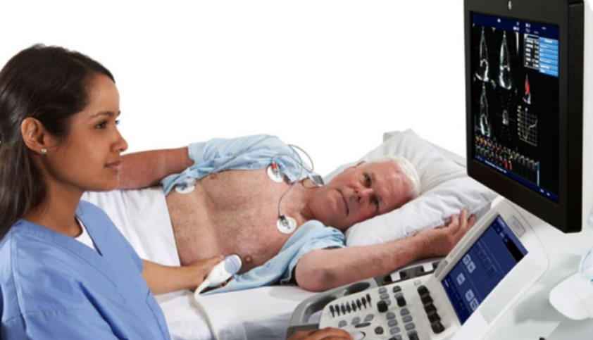 Stress Echocardiogra
