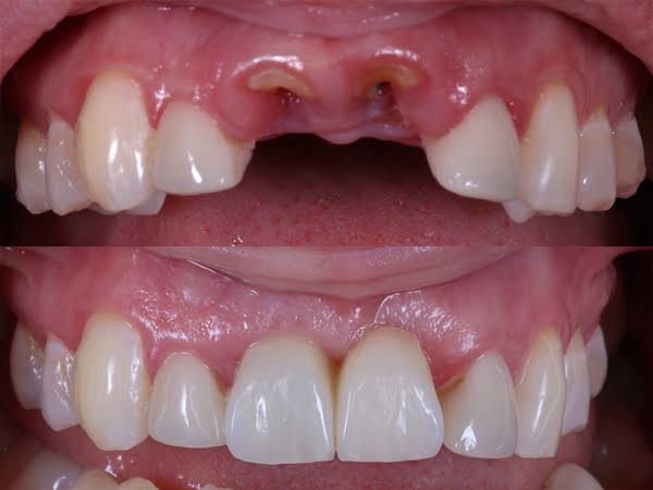 🌟 Transform Your Smile with Expert of Dental Im... main image