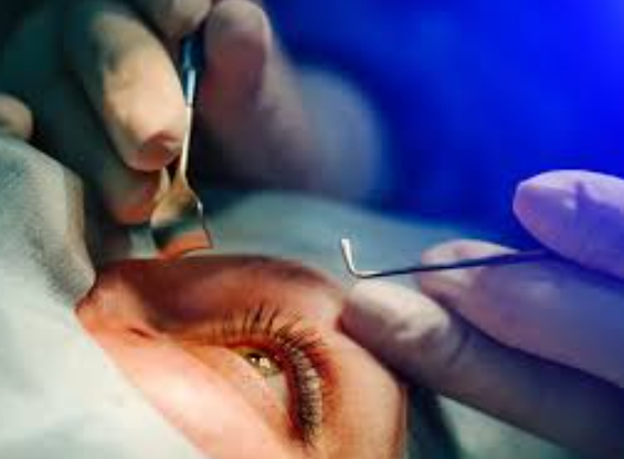 Cataract Treatment by Laser at ISHA NETRALAYA C... main image