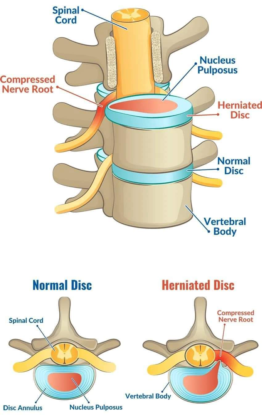 Physiotherapy clinic in Tambaram
Are you Looking f... main image