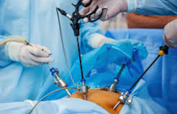 Laparoscopic Surgery at LifeShell Hospital, Nas... main image