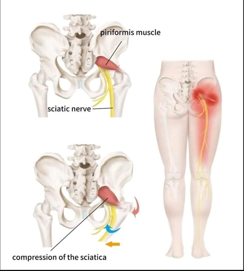 Physiotherapy clinic in Tambaram
Are you Lookin... main image